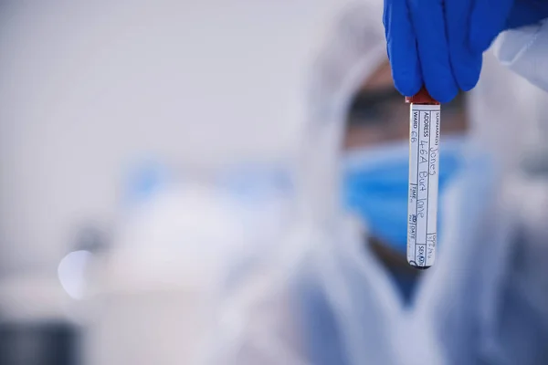 Ręka Nauka Makieta Próbką Krwi Laboratorium Lub Innowacje Lub Badania — Zdjęcie stockowe