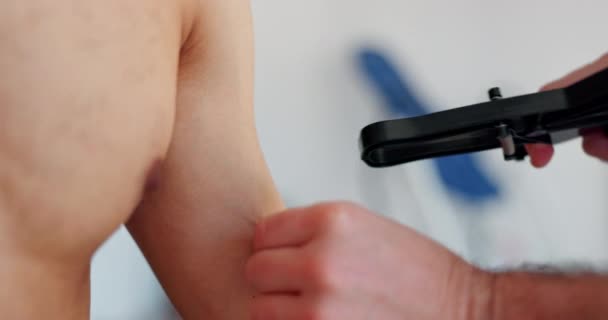 Tělesný Tuk Muž Fyzioterapeutický Test Rukou Kožním Záhybem Nástrojem Klinice — Stock video