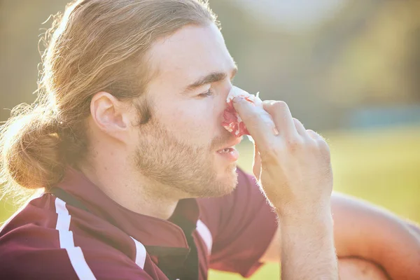 Nose Bleed Man Closeup Sports Injury Closeup Field Emergency Health — Stock Photo, Image