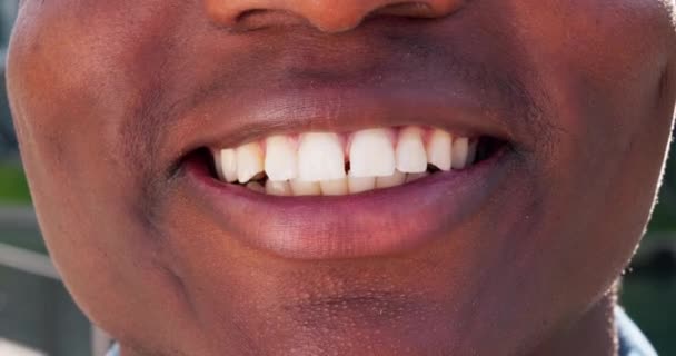 Homem Boca Dentes Clareamento Com Fecho Dentário Sorriso Saúde Com — Vídeo de Stock