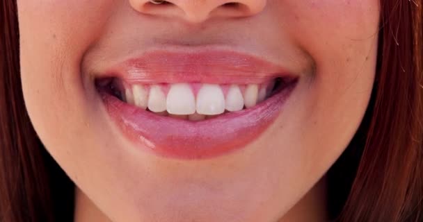 Mulher Boca Dentes Clareamento Com Fecho Dentário Sorriso Saúde Com — Vídeo de Stock
