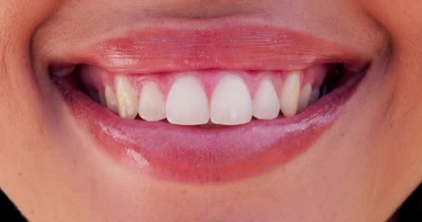 Жінка Губи Відбілювання Зубів Вінірами Стоматологічного Крупним Планом Посмішка Щастя — стокове відео