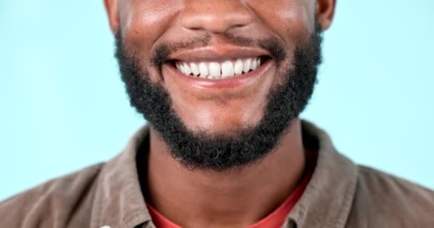 Blanqueamiento Dental Primer Plano Rostro Del Hombre Con Una Sonrisa — Vídeos de Stock