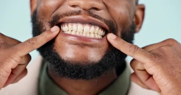 在蓝色背景下被隔离的工作室里 男人的嘴巴 牙齿和特写的笑容 快乐的脸蛋 指牙齿美白 口腔护理及健康牙龈等方面的唇及牙齿卫生 以促进牙医的健康 — 图库视频影像