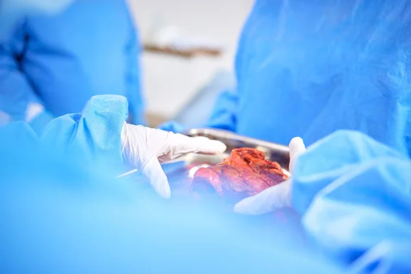 Transplantace Orgánů Operace Rukou Lékařů Lékařská Podpora Nebo Týmová Práce — Stock fotografie