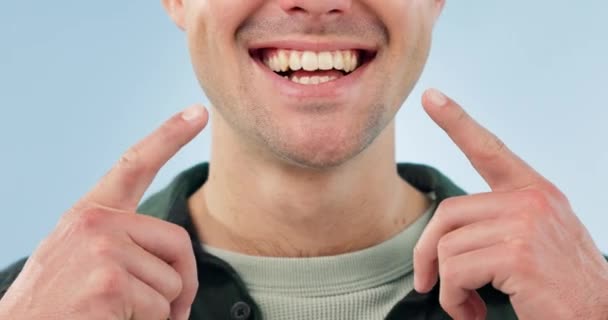 Sorriso Salute Dentale Una Persona Che Punta Alla Bocca Pulizia — Video Stock