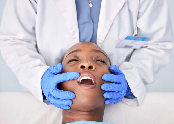 Dentist check teeth, patient and people at clinic, consultation and mouth with dental health and medical treatment. Oral hygiene, healthcare and surgery, orthodontics and tooth decay with hands.