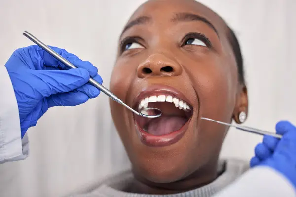 Dentist hands, patient mouth and tools, check teeth for dental health and medical treatment. Oral hygiene, healthcare and orthodontics, black woman with tooth decay and clean for cavity and excavator.
