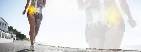 Runner Nohy Poranění Kyčle Rentgen Banner Venkovní Fitness Cvičení Anatomie — Stock fotografie