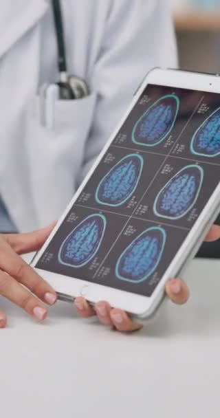 Person Händer Och Läkare Tablett Med Hjärnskanning För Röntgen Kirurgi — Stockvideo