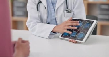 Doktor, hasta ve tartışmalı tablet sonuçları, beyin taramaları ve sağlık hizmetleri danışmanlığı. Teşhis, tıp profesyoneli ve kanser için sağlık, ameliyat ve dijital MRI konulu sohbet.