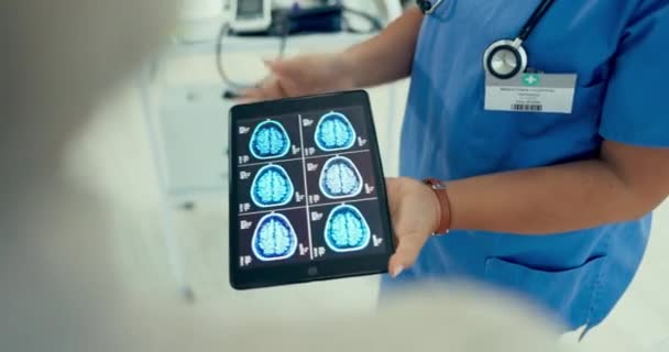 医師の脳スキャン タブレットスクリーン 人の手は 医療相談でMriの結果 がん診断または心X線を示しています 解剖検査によるコンサルティング看護師 放射線科 神経外科医 — ストック動画