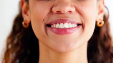 Gülen kadının eğri dişlerini ortodontik görünmez diş telleriyle düzleştirip hizaya getirmesine yakın çekim. Gülümseyen, mutlu ve kendine güvenen bir kadının portresi. Sağlıklı ağız ve diş bakımını destekliyor..
