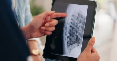Eller, röntgen ve tabletteki doktorlar hastanede tartışıp plan yapıyorlar. Sağlık hizmetleri toplantısında kemik radyolojisi, dijital teknoloji ve sağlık çalışanlarının danışma, tarama ve ekran ile kapatılması.