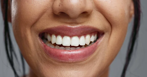 Mulher Boca Close Estúdio Para Bem Estar Dental Beleza Mudança — Fotografia de Stock
