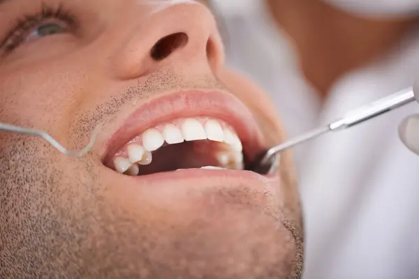 Κοντινό Πλάνο Άνθρωπος Και Οδοντίατρος Εργαλεία Στο Στόμα Για Την — Φωτογραφία Αρχείου