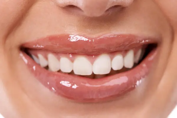 Крупный План Отбеливание Губ Зубов Женщиной Красоты Макияж Блеском Гидратации Стоковое Изображение