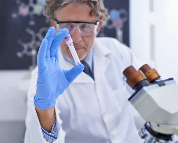 Nauka Laboratorium Człowiek Fiolką Mikroskopem Badań Medycznych Analiz Opracowywania Szczepionek — Zdjęcie stockowe