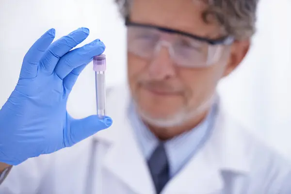 Bilim Laboratuvar Tıbbi Araştırma Analiz Aşı Geliştirme Için Örnek Toplayan — Stok fotoğraf