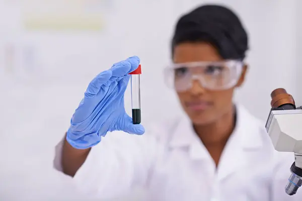 Sangue Mão Cientista Com Tubo Ensaio Laboratório Para Investigação Científica — Fotografia de Stock