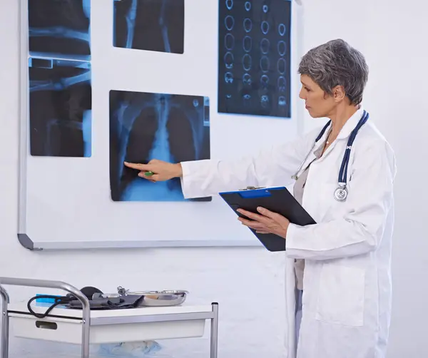Médecin Principal Femme Radiographie Médicale Avec Presse Papiers Pour Liste — Photo