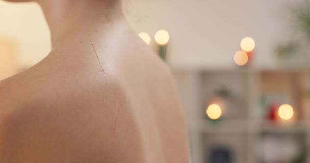 Rygg Nål Och Akupunktur Behandling För Hälsa Välbefinnande Och Holistisk — Stockvideo