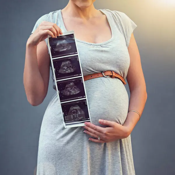 Woman Pregnant Child Ultrasound Studio Maternity Shoot Album Baby Shower — Stock Photo, Image