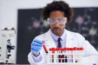 İnsan, patoloji ve laboratuarda kan testi tüpü, deney için bilim ve biyokimya. Siyahi kişi, biyoloji ve DNA araştırmaları sağlık hizmetleri, RNA ve tıbbi yenilik çalışması süreci.