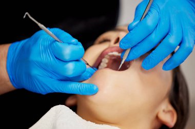 Klinikte diş ağrısı için diş hekimi, hasta ve diş hekimi, ağız sağlığı için tedavi. Diş beyazlatma, temizlik ve tıbbi ekipmanlı kişi, denetleme ve ortodonti için ağız bakımı.