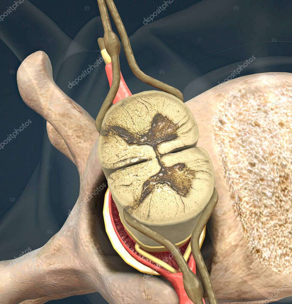 El nervio espinal es un nervio mixto que transporta señales motoras