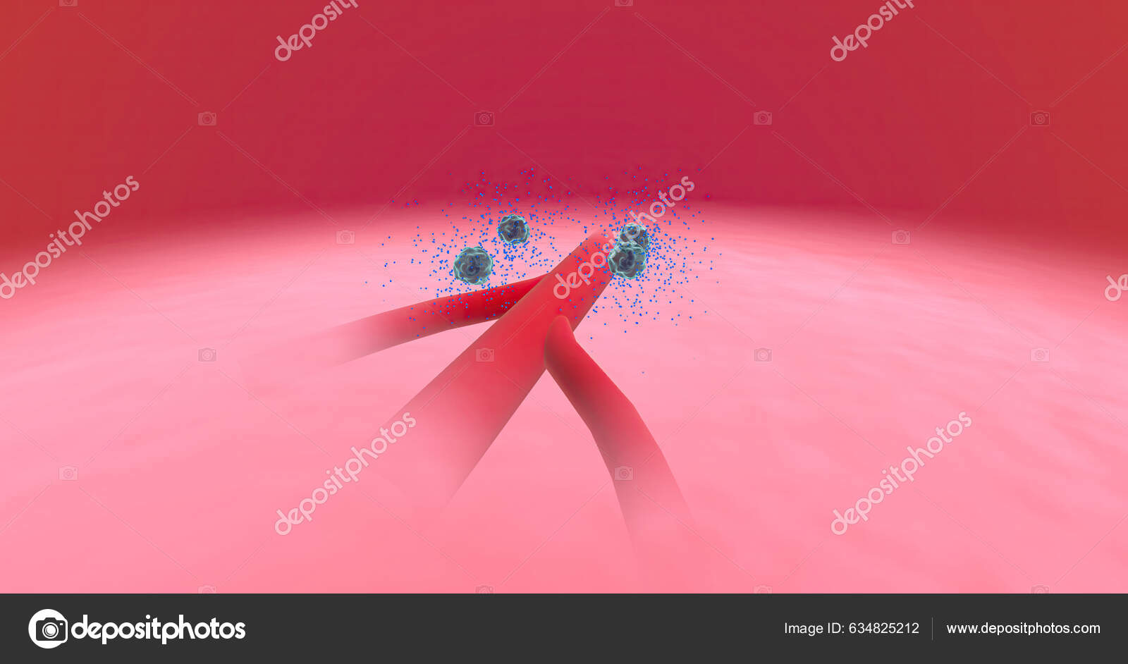 Anaphylaxis Histamine Release Vascular Edema Rendering fotografía de