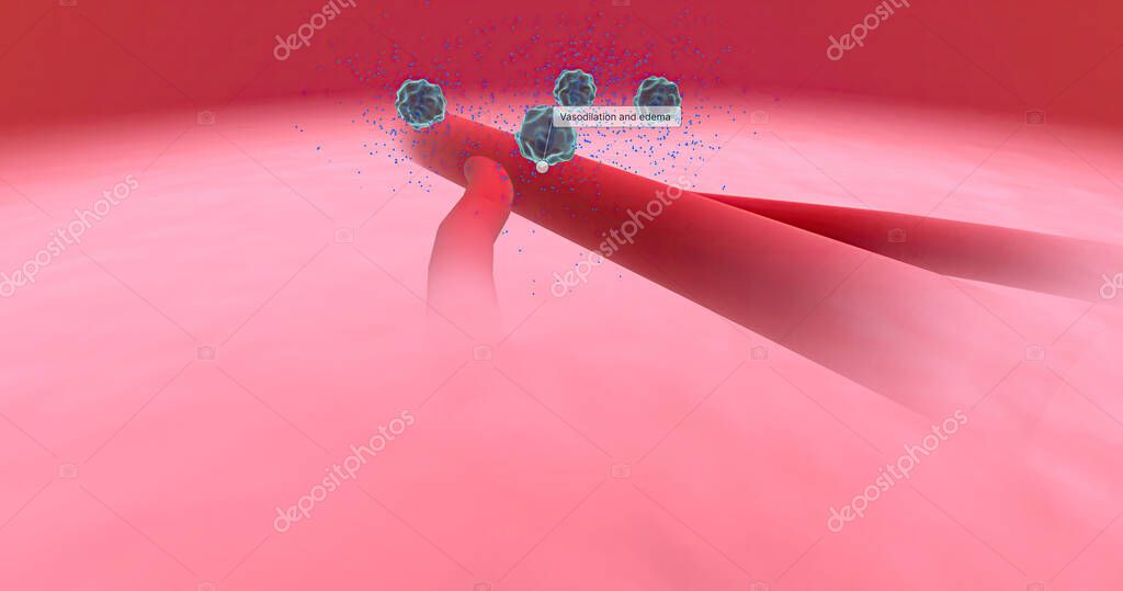 Anaphylaxis, Histamine Release and Vascular Edema 3D rendering 2023