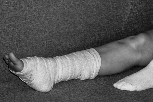 Woman with broken leg. female bandaging foot on the floor. The concept of a sore person with a limb injury. Close-up.