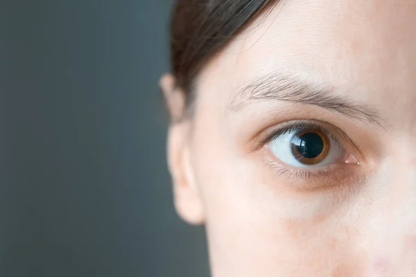Close Womans Brown Eye Dilated Big Pupil Eye Drops Visit — Stock Photo, Image