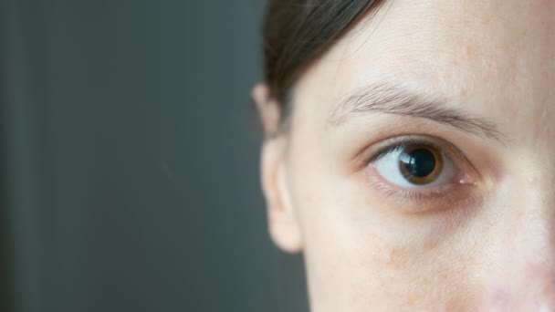 Close Womans Brown Eye Dilated Big Pupil Eye Drops Visit — Stock Video