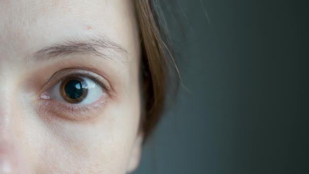Zbliżenie Brunatny Oko Kobieta Rozwarty Duży Uczeń Krople Oczu Wizycie — Wideo stockowe