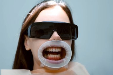 Ağzında retraktör olan sarı dişli kadın portresi dişçiyi bekliyor. Diş hekimliğinde koruyucu gözlük takıyor. Diş tedavisi ve diş tedavisi kavramı.