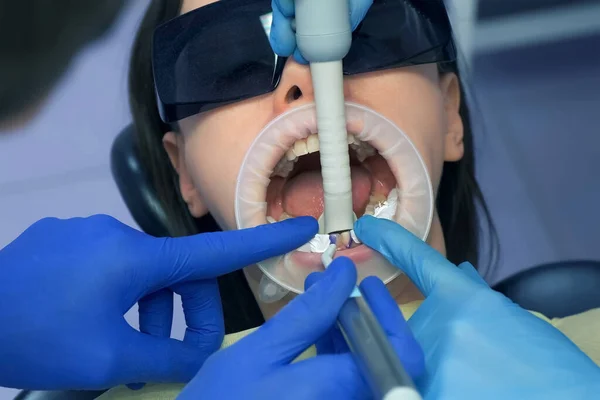 Dentista Está Lavando Ácido Azul Los Dientes Las Mujeres Antes — Foto de Stock