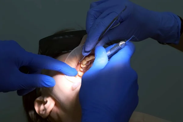 Dentist puts the thread to stop the bleeding between tooth and gum of the patient. Close-up of the oral cavity in the process of dental treatment. Dentistry, prosthetics concept. Orthodontist cure.