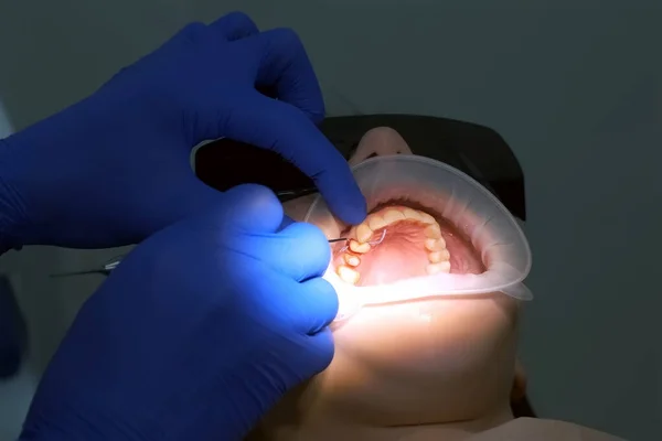 Dentista Pone Hilo Para Detener Sangrado Entre Diente Encía Del — Foto de Stock