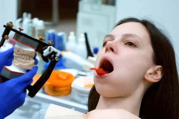 Frau Mit Prothesenabdruck Auf Dem Unterkiefer Der Zahnmedizin Eine Prothese — Stockfoto