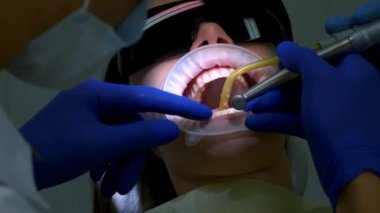 Dişçi kadın dişlerini seramik kaplama ve kaplama takmak için matkapla hazırlıyor. Dişlerinin bir kısmını söküyor. Dişçilik, protez konsepti. Bir ortodontist tarafından tedavi.