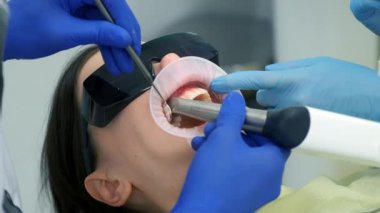 Dişçi seramik kaplama ve kaplama takmadan önce kadın için intraoral tarama yapıyor. Ortodontist elinde çene ve ağız için 3D tarayıcı tutuyor. Prostodonti konsepti.