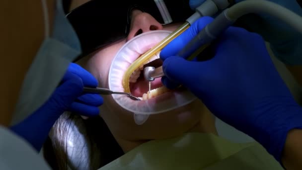 Οδοντίατρος Ετοιμάζει Δόντια Των Γυναικών Για Την Εγκατάσταση Κεραμικών Καπλαμά — Αρχείο Βίντεο
