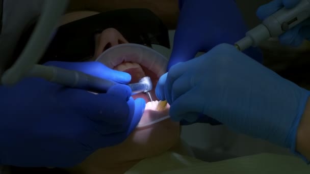 Stomatologul Pregătește Dinții Femeilor Pentru Instalarea Furnir Ceramic Coroane Folosind — Videoclip de stoc