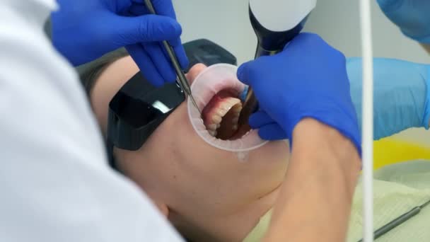 Стоматолог Робить Внутрішньооральний Сканування Жінки Перед Встановленням Керамічних Шлейфів Вінців — стокове відео