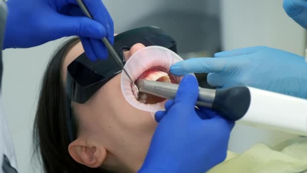 Dentista Está Haciendo Escaneo Intraoral Para Mujer Antes Instalar Carillas — Vídeo de stock