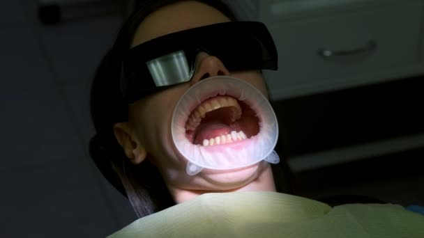 在安装牙科之前 先在妇女的黄色牙齿上试戴白色牙面 假牙的概念 牙齿矫正师的治疗 口腔科张嘴 拉扯的妇女 — 图库视频影像