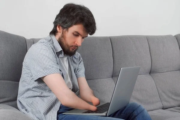 Özürlü Bir Adam Sakat Iki Kolu Kesilmiş Bilgisayarında Koltukta Oturmuş — Stok fotoğraf