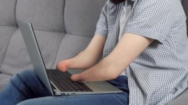 Elleri kesilmiş engelli bir adam dizüstü bilgisayarda çalışırken koltukta oturuyor, elleri kapalı. Engelli insanlara uyum sağlama sorunu. Bağımsız Bağımsız kişi.